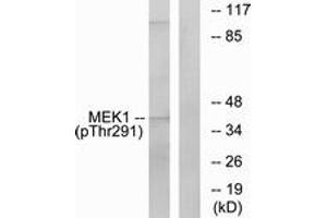 Western Blotting (WB) image for anti-Mitogen-Activated Protein Kinase Kinase 1 (MAP2K1) (pThr291) antibody (ABIN2888470) (MEK1 anticorps  (pThr291))