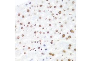 Immunohistochemistry of paraffin-embedded mouse liver using Argonaute-2 antibody (ABIN6133693, ABIN6140045, ABIN6140047 and ABIN6221669) at dilution of 1:100 (40x lens).