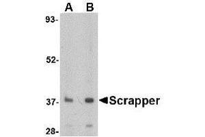 Image no. 1 for anti-F-Box and Leucine-Rich Repeat Protein 20 (FBXL20) (N-Term) antibody (ABIN1494347) (FBXL20 anticorps  (N-Term))