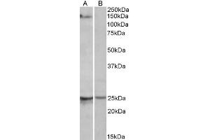 ABIN571262 (1µg/ml) staining of Mouse Heart lysate (35µg protein in RIPA buffer) with (B) and without (A) blocking with the immunising peptide. (RBM20 anticorps  (AA 717-727))
