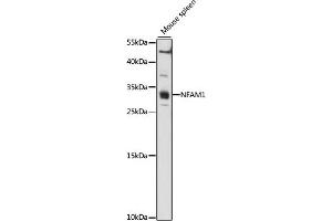 Western blot analysis of extracts of Mouse spleen, using NF antibody (ABIN7268902) at 1:1000 dilution.