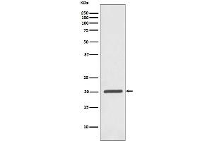 Western blot analysis of Ferritin expression in Jurkat cell lysate.