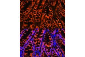 Immunofluorescence analysis of mouse colon using YB-1/YB-1/YBX1 antibody (ABIN6134494, ABIN6150328, ABIN6150330 and ABIN7101815) at dilution of 1:100.