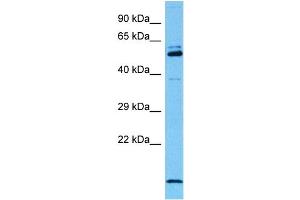 Host:  Mouse  Target Name:  MYEF2  Sample Tissue:  Mouse Testis  Antibody Dilution:  1ug/ml (MYEF2 anticorps  (Middle Region))