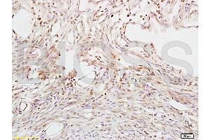 Formalin-fixed and paraffin embedded mouse uterus tissue labeled with Anti-ABP/SHBG Polyclonal Antibody, Unconjugated (ABIN739860) at 1:200 followed by conjugation to the secondary antibody and DAB staining (SHBG anticorps  (AA 51-150))