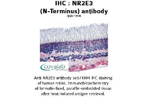 Image no. 1 for anti-Nuclear Receptor Subfamily 2, Group E, Member 3 (NR2E3) (N-Term) antibody (ABIN1737506)