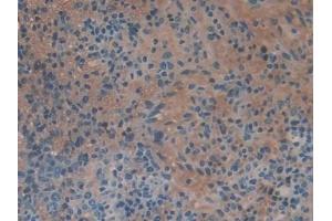 Detection of CBG in Mouse Spleen Tissue using Polyclonal Antibody to Corticosteroid Binding Globulin (CBG)