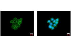 ICC/IF Image Caveolin 1 antibody [N1N3] detects Caveolin 1 protein at membrane by immunofluorescent analysis.