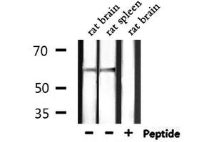 Western blot analysis of extracts from rat brain,rat spleen, using SLC9A8 Antibody.