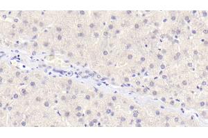 Detection of OPG in Human Liver Tissue using Monoclonal Antibody to Osteoprotegerin (OPG)