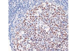 Immunohistochemistry of paraffin-embedded Human tonsil using DNMT1 Polyclonal Antibody at dilution of 1:200 (40x lens).