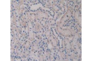 IHC-P analysis of Rat Kidney Tissue, with DAB staining. (TLR4 anticorps  (AA 49-247))
