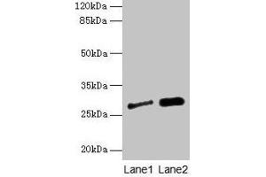 Western blot All lanes: IGFBP1 antibody at 3 μg/mL Lane 1: A549 whole cell lysate Lane 2: PC-3 whole cell lysate Secondary Goat polyclonal to rabbit IgG at 1/10000 dilution Predicted band size: 28 kDa Observed band size: 28 kDa (IGFBPI anticorps  (AA 26-259))