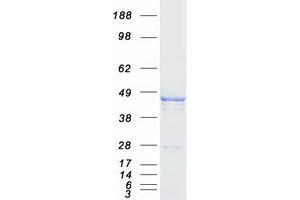 Validation with Western Blot