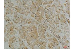 Immunohistochemistry (IHC) analysis of paraffin-embedded Mouse Skeletal Muscle Tissue using Desmin(Monoclonal Antibody diluted at 1:200. (Desmin anticorps)