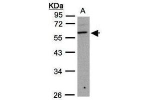 WB Image Sample(30 ug whole cell lysate) A:293T 10% SDS PAGE antibody diluted at 1:1000 (B3GNT3 anticorps)
