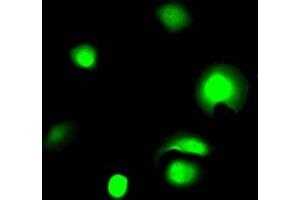 Immunofluorescence staining of MCF7 Cells with ABIN7127508 at 1:50, counter-stained with DAPI. (Recombinant Galectin 3 anticorps)