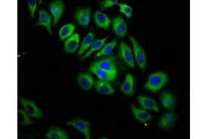 Immunofluorescence staining of A549 cells with ABIN7156494 at 1:133, counter-stained with DAPI.