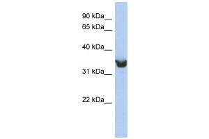 DLK1 antibody used at 1 ug/ml to detect target protein. (DLK1 anticorps)