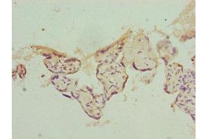 Immunohistochemistry of paraffin-embedded human placenta tissue using ABIN7142198 at dilution of 1:100