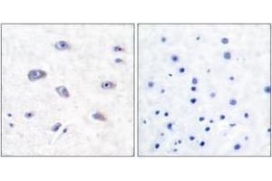 Immunohistochemistry analysis of paraffin-embedded human brain tissue, using BACE (Ab-498) Antibody. (BACE1 anticorps  (AA 452-501))
