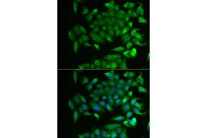 Immunofluorescence analysis of MCF-7 cells using RBP2 antibody.