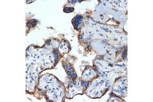 Immunohistochemistry of paraffin-embedded human placenta using NLK Rabbit mAb (ABIN7268846) at dilution of 1:100 (40x lens).