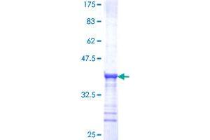 Image no. 1 for Transient Receptor Potential Cation Channel, Subfamily A, Member 1 (TRPA1) (AA 1033-1117) protein (GST tag) (ABIN1323814)