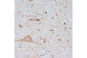 Immunohistochemistry of paraffin-embedded rat brain using SLC18 antibody (ABIN7270410) at dilution of 1:200 (40x lens).