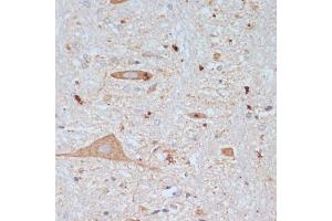 Immunohistochemistry of paraffin-embedded rat brain using SLC18 antibody (ABIN7270410) at dilution of 1:200 (40x lens). (SLC18A3 anticorps  (AA 1-150))