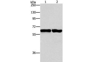 Western Blot analysis of 231 and NIH/3T3 cell using ASNS Polyclonal Antibody at dilution of 1:800 (Asparagine Synthetase anticorps)