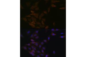 Immunofluorescence analysis of C6 cells using PP2A alpha + beta Rabbit mAb (ABIN7269686) at dilution of 1:100 (40x lens). (PPP2CB anticorps)