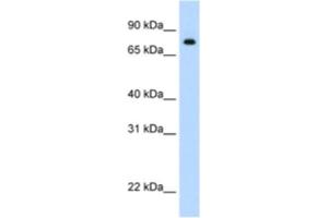 Western Blotting (WB) image for anti-Signal Transducer and Activator of Transcription 1, 91kDa (STAT1) antibody (ABIN2461816) (STAT1 anticorps)