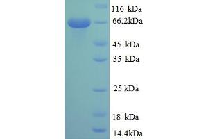 SDS-PAGE (SDS) image for Nuclear Receptor Subfamily 2, Group C, Member 2 (NR2C2) (AA 3-592), (partial) protein (His tag) (ABIN5713012)
