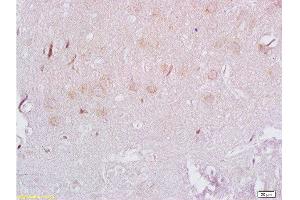 Formalin-fixed and paraffin embedded rat brain labeled with Rabbit Anti ADRB3/beta 3 Adrenergic Receptor Polyclonal Antibody, Unconjugated  at 1:200 followed by conjugation to the secondary antibody and DAB staining