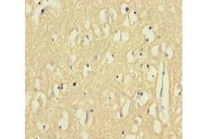 Immunohistochemistry of paraffin-embedded human brain tissue using ABIN7145308 at dilution of 1:100 (BCL2L2 anticorps  (AA 2-193))
