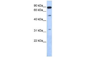 SENP5 antibody used at 1 ug/ml to detect target protein. (SENP5 anticorps  (Middle Region))