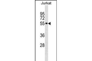 SF3A2 Antibody (Center) (ABIN1881795 and ABIN2838933) western blot analysis in Jurkat cell line lysates (35 μg/lane). (SF3A2 anticorps  (AA 166-194))