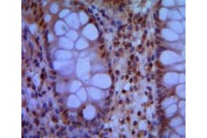 Immunohistochemical analysis of paraffin-embedded human colon using SMC1 mouse mAb with DAB staining. (SMC1A anticorps)
