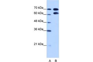 Western Blotting (WB) image for anti-Ribonucleoprotein, PTB-Binding 1 (RAVER1) antibody (ABIN2462325) (RAVER1 anticorps)