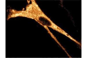 Immunofluorescence staining of WI-38 cells (Human lung fibroblasts, ATCC CCL-75). (RIPK1 anticorps  (AA 385-650))