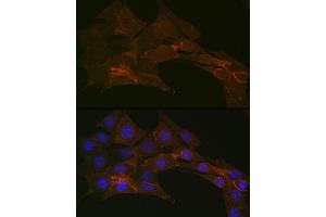 Immunofluorescence analysis of NIH-3T3 cells using Na+/K+-ATPase Rabbit mAb (ABIN7270390) at dilution of 1:100 (40x lens).