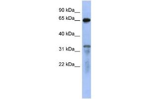 WB Suggested Anti-RAP1GAP  Antibody Titration: 0. (RAP1GAP anticorps  (Middle Region))