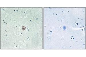 Immunohistochemistry analysis of paraffin-embedded human brain tissue, using EDG8 Antibody. (S1PR5 anticorps  (AA 335-384))
