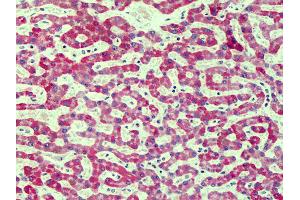 Anti-RAGE antibody IHC of human liver. (RAGE anticorps  (Cy3))