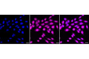 Immunocytochemical staining of HepG2 cells with Aryl hydrocarbon receptor antibody (ABIN7797656), 1:1,000). (Recombinant Aryl Hydrocarbon Receptor anticorps)