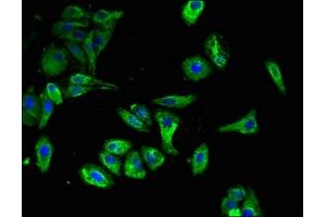 Immunofluorescent analysis of HepG2 cells using ABIN7146093 at dilution of 1:100 and Alexa Fluor 488-congugated AffiniPure Goat Anti-Rabbit IgG(H+L)