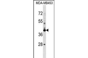 SRRD Antibody (Center) (ABIN1537981 and ABIN2848619) western blot analysis in MDA-M cell line lysates (35 μg/lane). (SRRD anticorps  (AA 184-213))