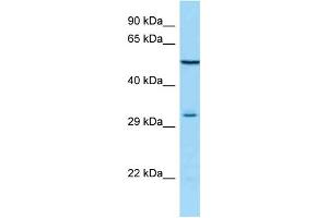 WB Suggested Anti-MAGEA12 Antibody Titration: 1. (MAGEA12 anticorps  (N-Term))