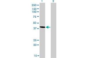 Western Blot analysis of TES expression in transfected 293T cell line by TES monoclonal antibody (M01), clone 1G11-B7.
